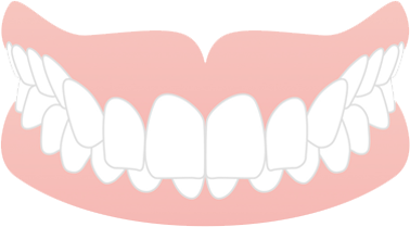 咬み合わせが深い
